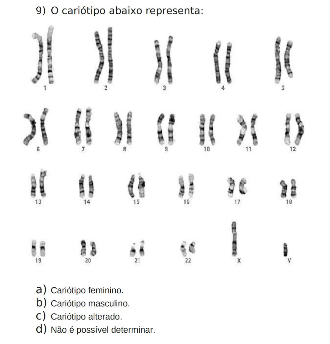 O cariótipo abaixo representa a Cariótipo feminino b Cariótipo