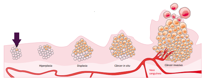 Neoplasia Biologia Geral