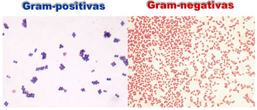 gram positiva e gram negativa